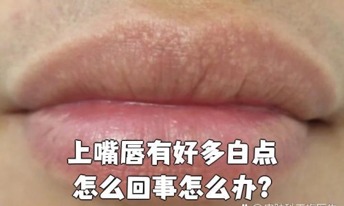 经期可以吃酸辣粉吗-孕妇可以吃酸辣粉丝吗专区_孕妇可以吃酸辣粉丝吗专区_生期间可以吃酸辣粉吗网